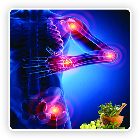 Osteoarthritis Image